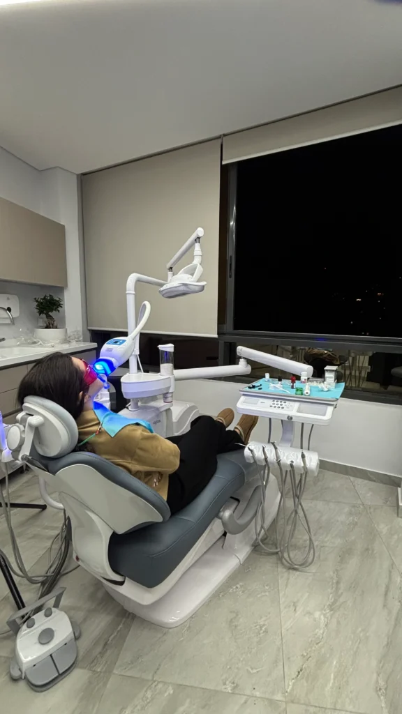 laser whitening beirut