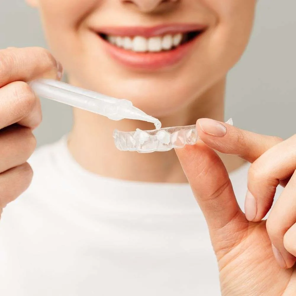 Are Commercial At-Home Whitening Kits in Lebanon Safe? at home whitening beriut