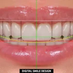 how to enhance my smile