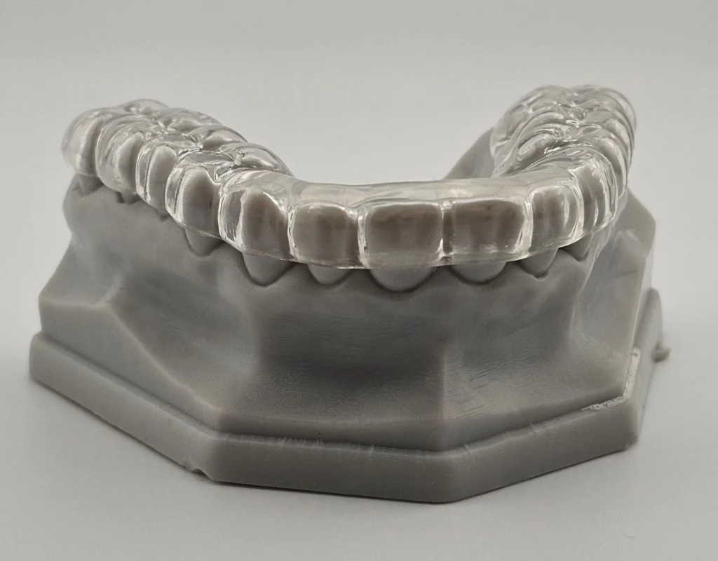 How to Stop Teeth Grinding at Night (Bruxism): Causes, Solutions, and When to See a Dentist nightguard beirut